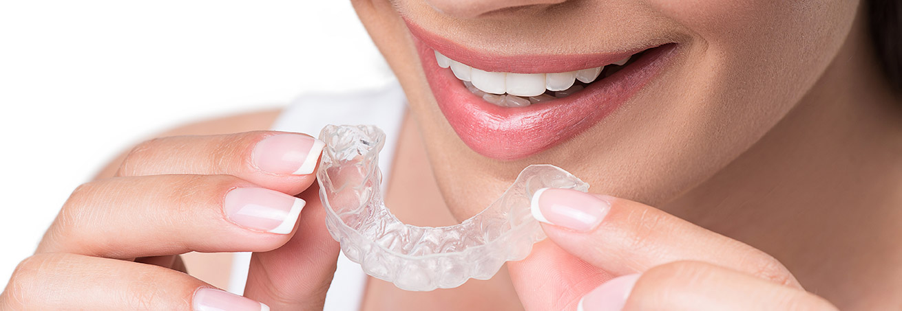 Aligner